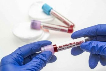 11 nəfər koronavirusa yoluxdu, ölən yoxdur 