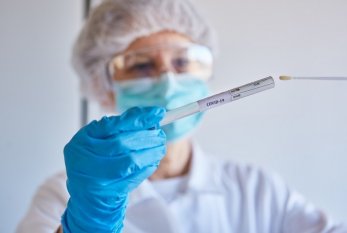 Azərbaycanda son sutkada koronavirusdan 2 nəfər öldü 
