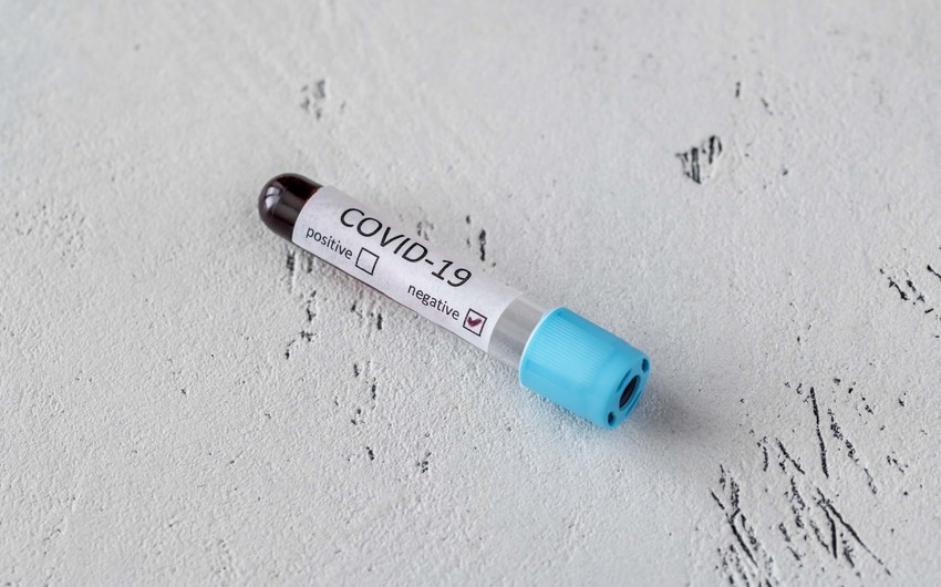 Son sutkada  koronavirusa yoluxanların sayı açıqlandı 