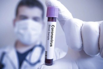 Azərbaycanda daha 53 nəfər koronavirusa yoluxdu 