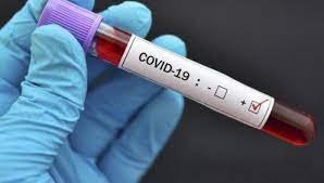 Bu gün 79 nəfər koronavirusa yoluxub, 6 nəfər vəfat etdi 
