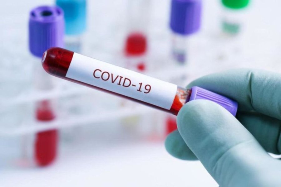 Azərbaycanda daha 24 nəfər koronavirusa yoluxub, 2 nəfər ölüb 