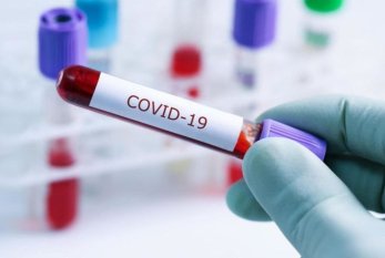 Azərbaycanda daha 24 nəfər koronavirusa yoluxub, 2 nəfər ölüb 