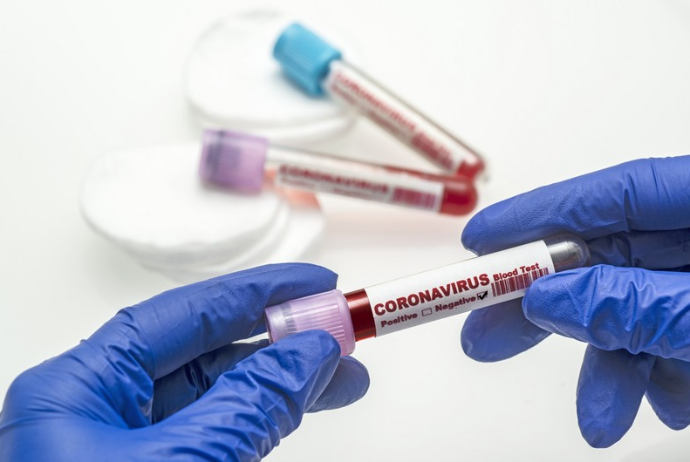 Son sutkada 13 nəfər koronavirusa yoluxdu - 1 nəfər öldü 