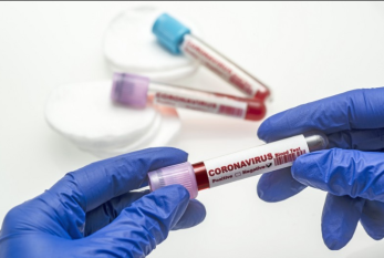 Son sutkada 13 nəfər koronavirusa yoluxdu - 1 nəfər öldü 