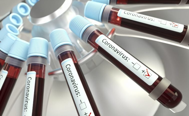 Koronavirus statistikası: 4 yoluxuma, 2 nəfər vəfat edib 