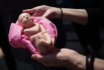 Ölkəmizdə qızlar arasında qeydə alınan abortların sayı AÇIQLANDI