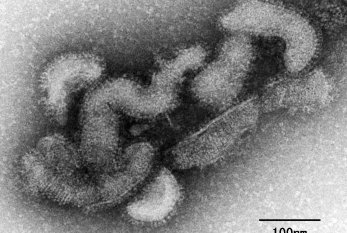 Dünyada ilk dəfə "Oz" virusuna yoluxma və ölüm halı qeydə alındı 