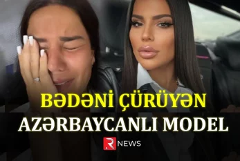 Bədəni çürüyən modellə bağlı YENİ XƏBƏR - VİDEO
