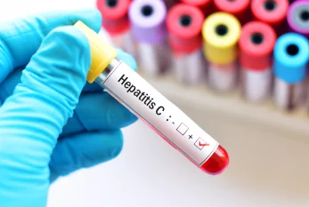 Hepatit C-nin müalicəsində misli görünməmiş UĞUR - AÇIQLAMA