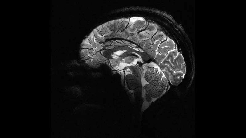 İnsan beyninin ən aydın görüntüsü - FOTO