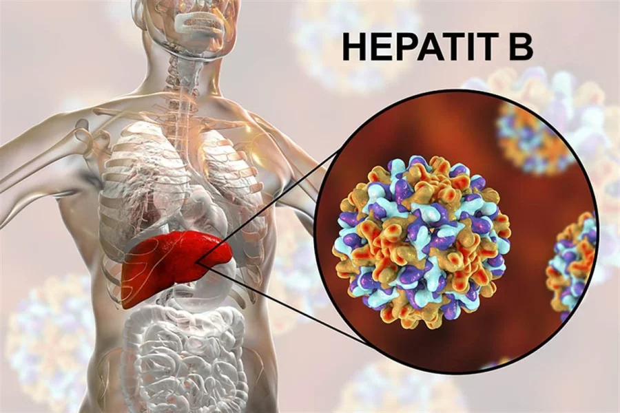 Hepatit B və C infeksiyasından hər gün 3500 insan ölür