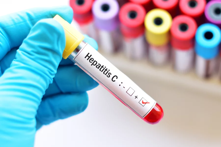 Fələstinlilərdə meningit və hepatit C aşkarlandı
