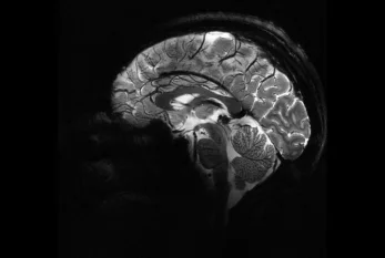 İnsan beyninin ən aydın görüntüsü - FOTO