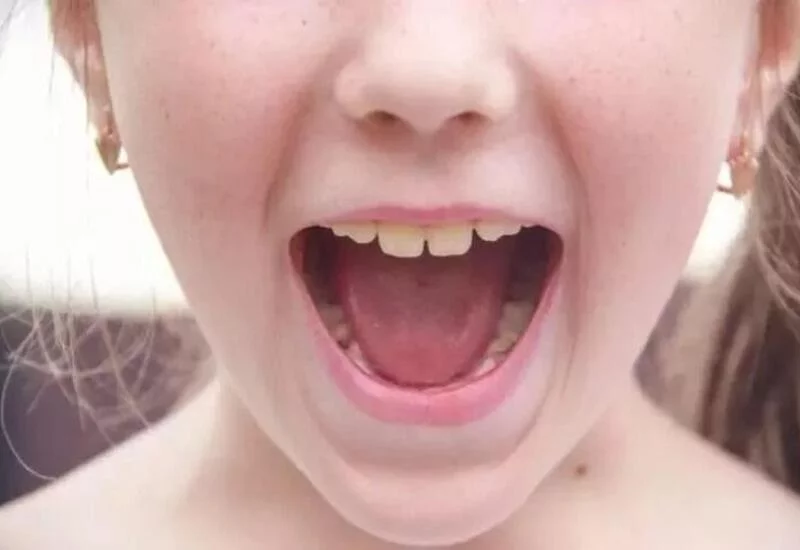 Süd dişləri niyə belə adlanır? 
