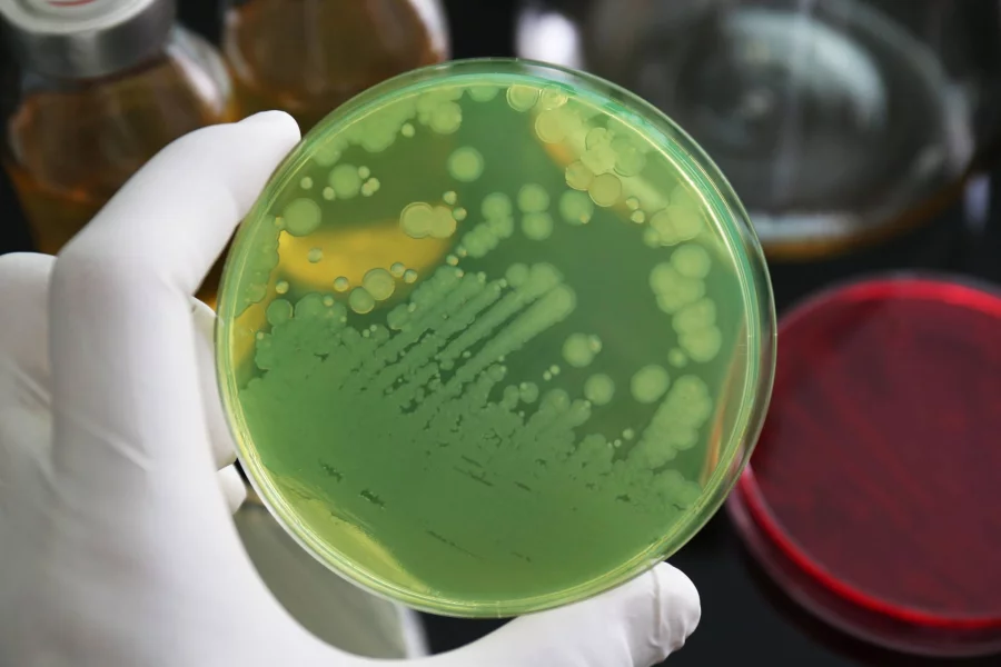 Bu bakteriya hər il yarım milyon insanı öldürür - Xəbərdarlıq