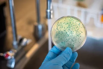 Dünyanın ən ölümcül patogeni: 